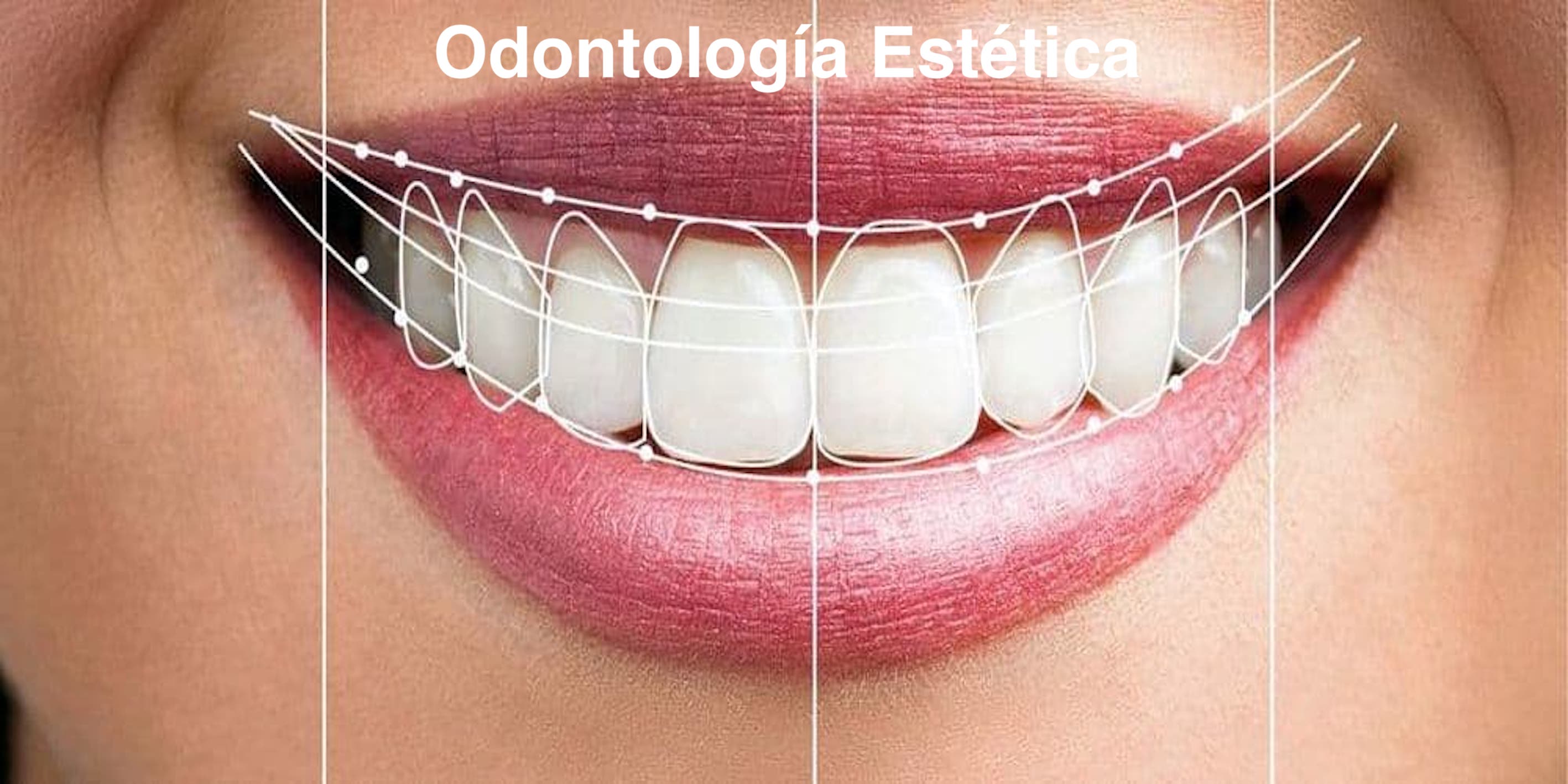 Odontología Estética<br>¡Consulta por tu hora aquí!