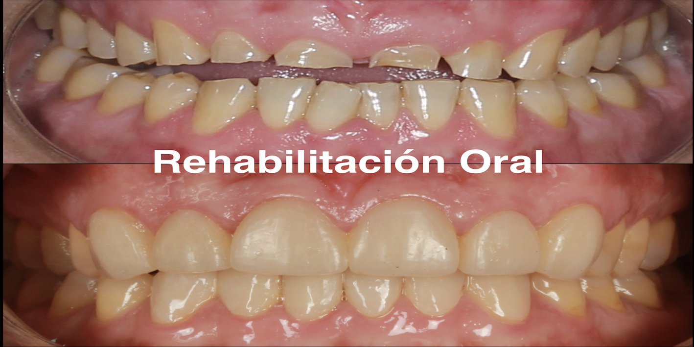 Rehabilitación Oral<br>¡Consulta por tu hora aquí!